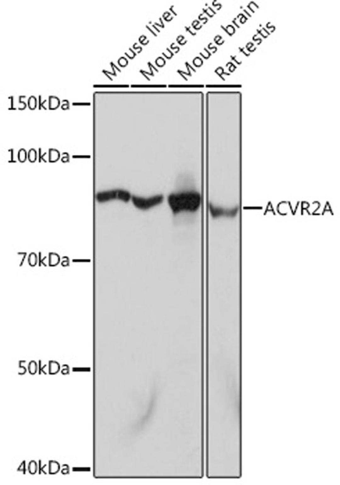 Western blot - ACVR2A Rabbit mAb (A5237)