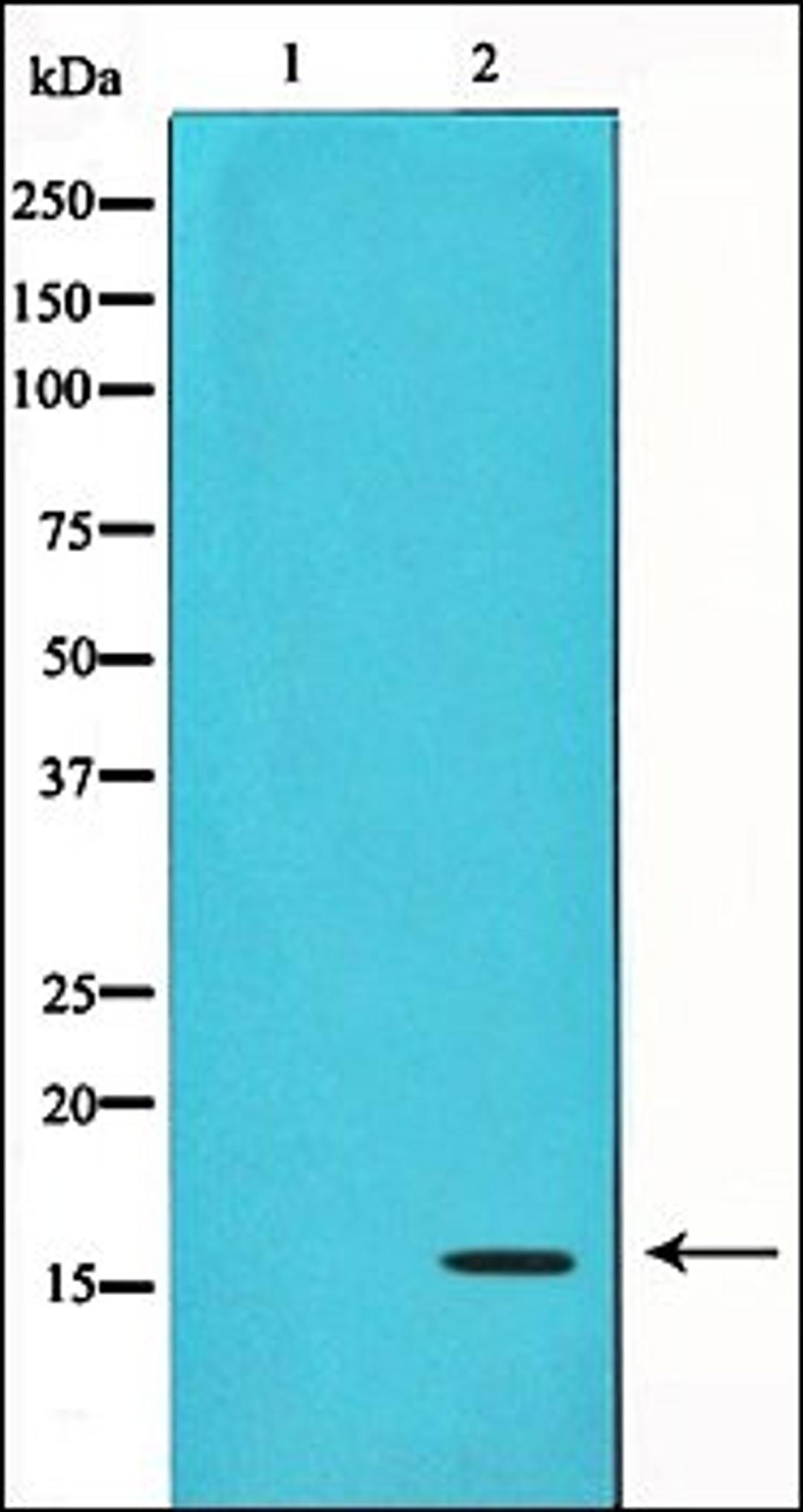 Western blot analysis of RAW2647 whole cell lysates using Acetyl-Histone H3 antibody