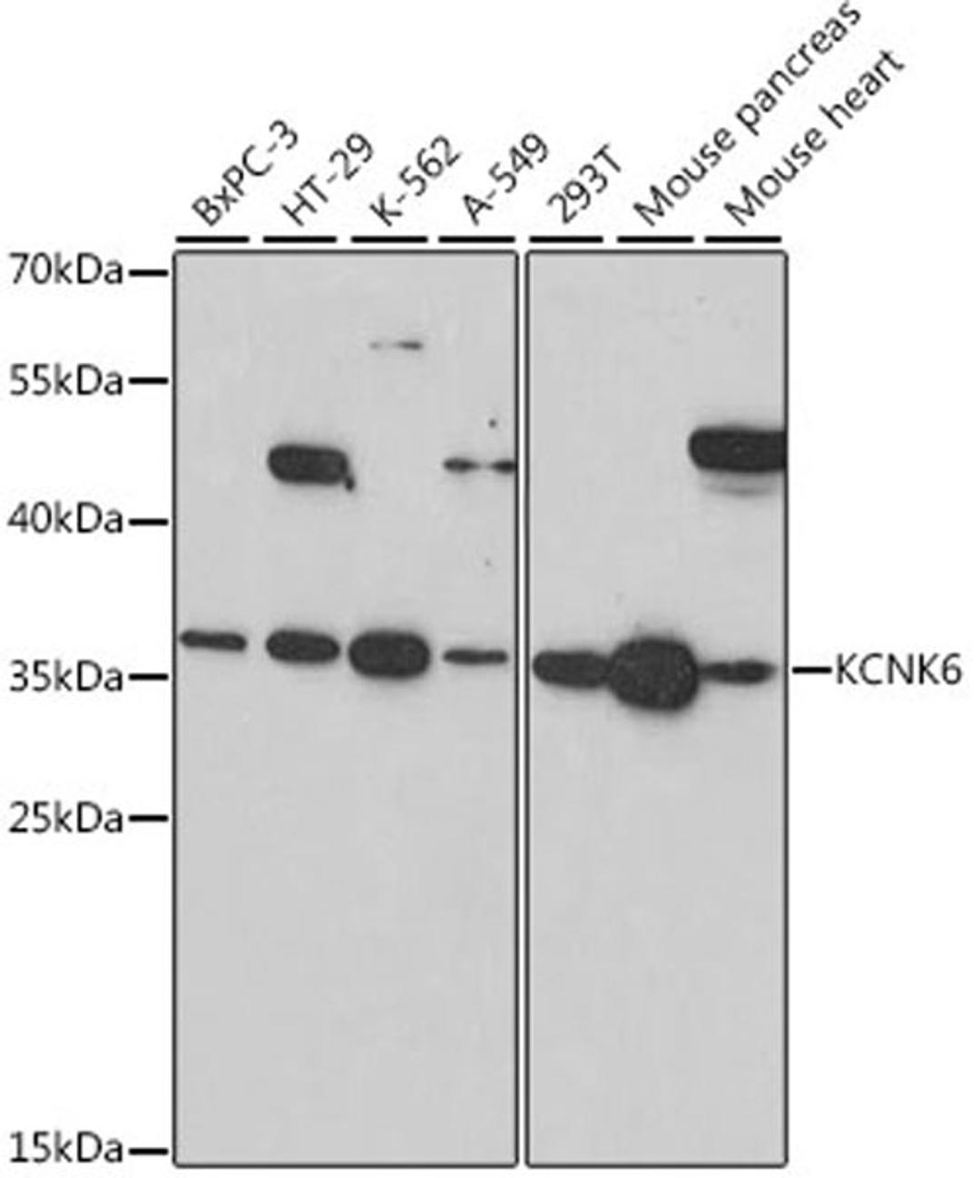 Western blot - KCNK6 antibody (A16087)