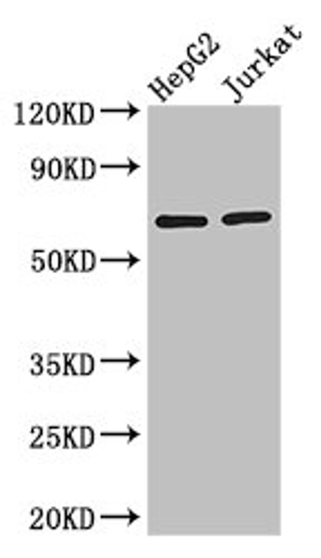 Western Blot. Positive WB detected in: HepG2 whole cell lysate, Jurkat whole cell lysate. All lanes: RUNX1T1 antibody at 2.8ug/ml. Secondary. Goat polyclonal to rabbit IgG at 1/50000 dilution. Predicted band size: 68, 65, 69, 64, 49, 45 kDa. Observed band size: 68 kDa. 