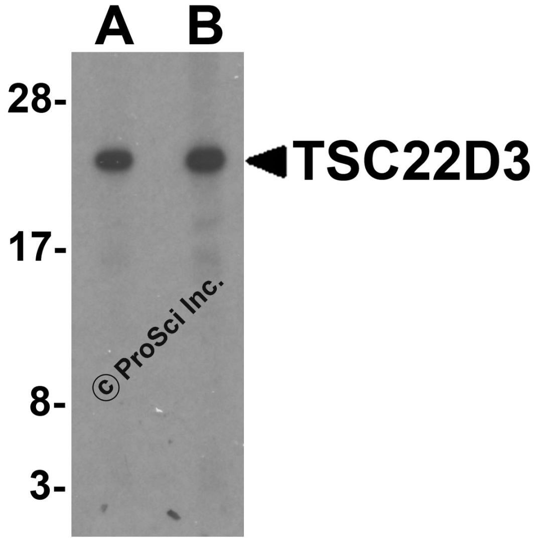 Western blot analysis of TSC22D3 in human small intestine tissue lysate with TSC22D3 antibody at (A) 1 and (B) 2 &#956;g/mL.