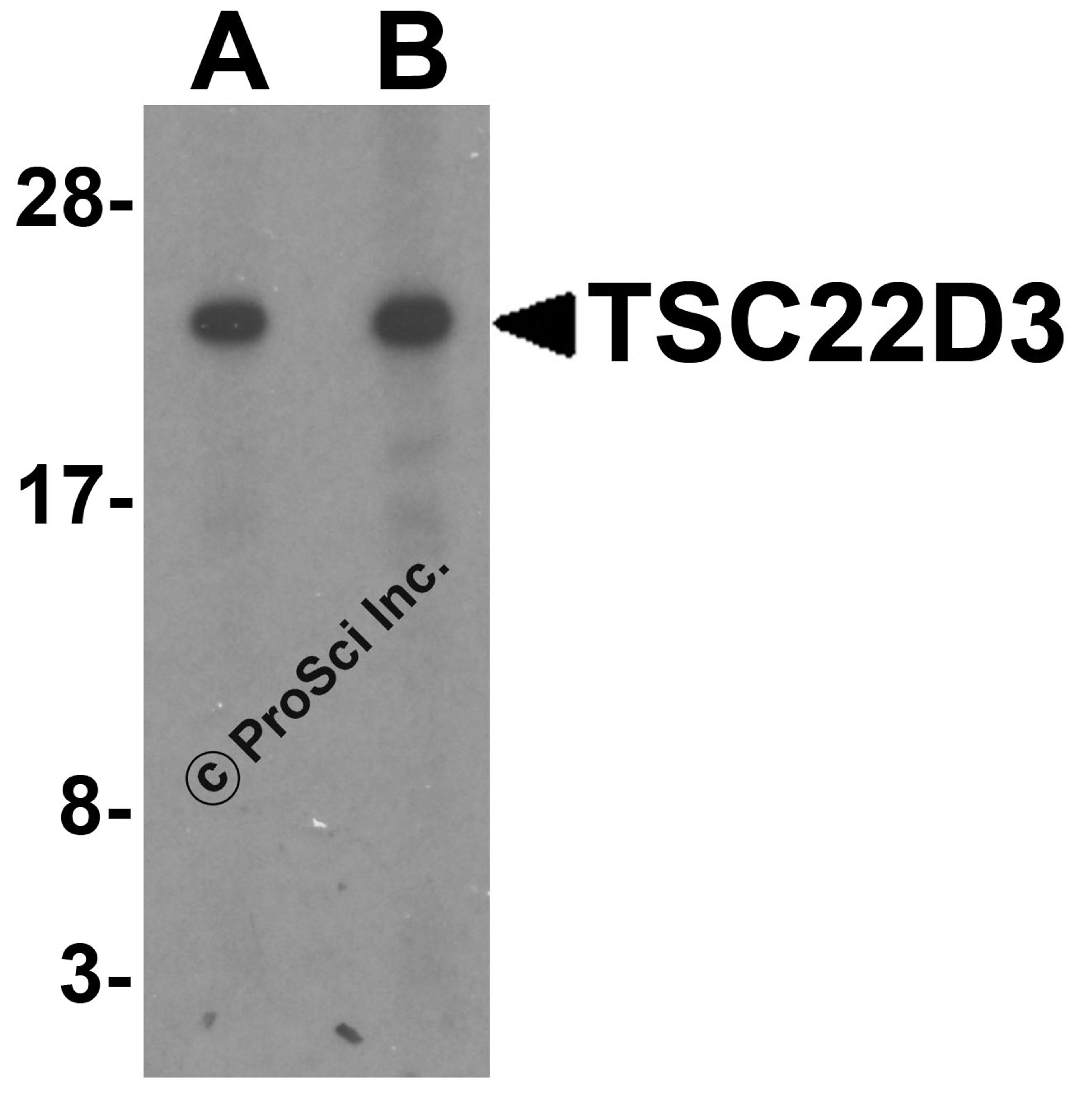 Western blot analysis of TSC22D3 in human small intestine tissue lysate with TSC22D3 antibody at (A) 1 and (B) 2 &#956;g/mL.