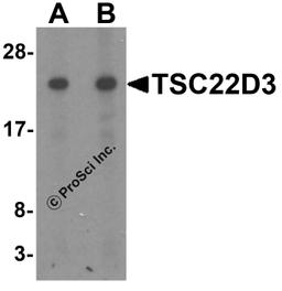 Western blot analysis of TSC22D3 in human small intestine tissue lysate with TSC22D3 antibody at (A) 1 and (B) 2 μg/mL.