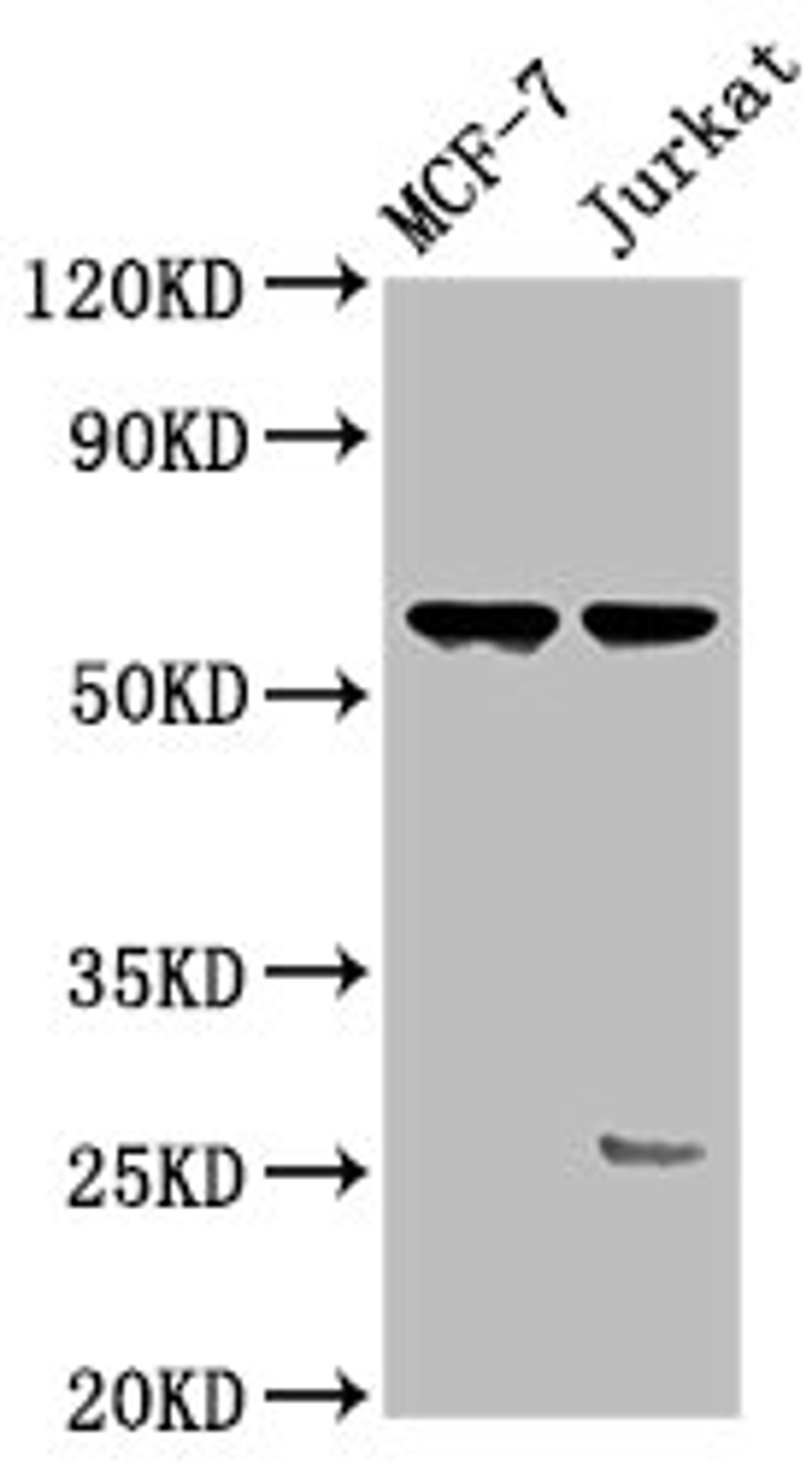 Western Blot. Positive WB detected in: MCF-7 whole cell lysate, Jurkat whole cell lysate. All lanes: STRA8 antibody at 3.4ug/ml. Secondary. Goat polyclonal to rabbit IgG at 1/50000 dilution. Predicted band size: 37 kDa. Observed band size: 60 kDa.