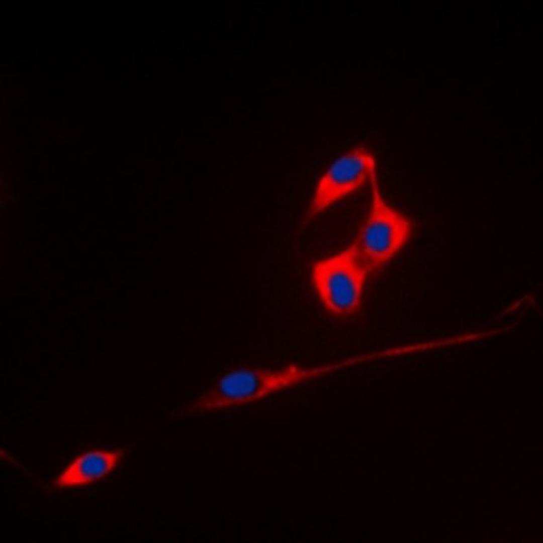 Immunofluorescense analysis of A431 cells using ECHOS1 antibody