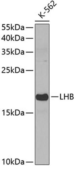 Western blot - LHB antibody (A3000)