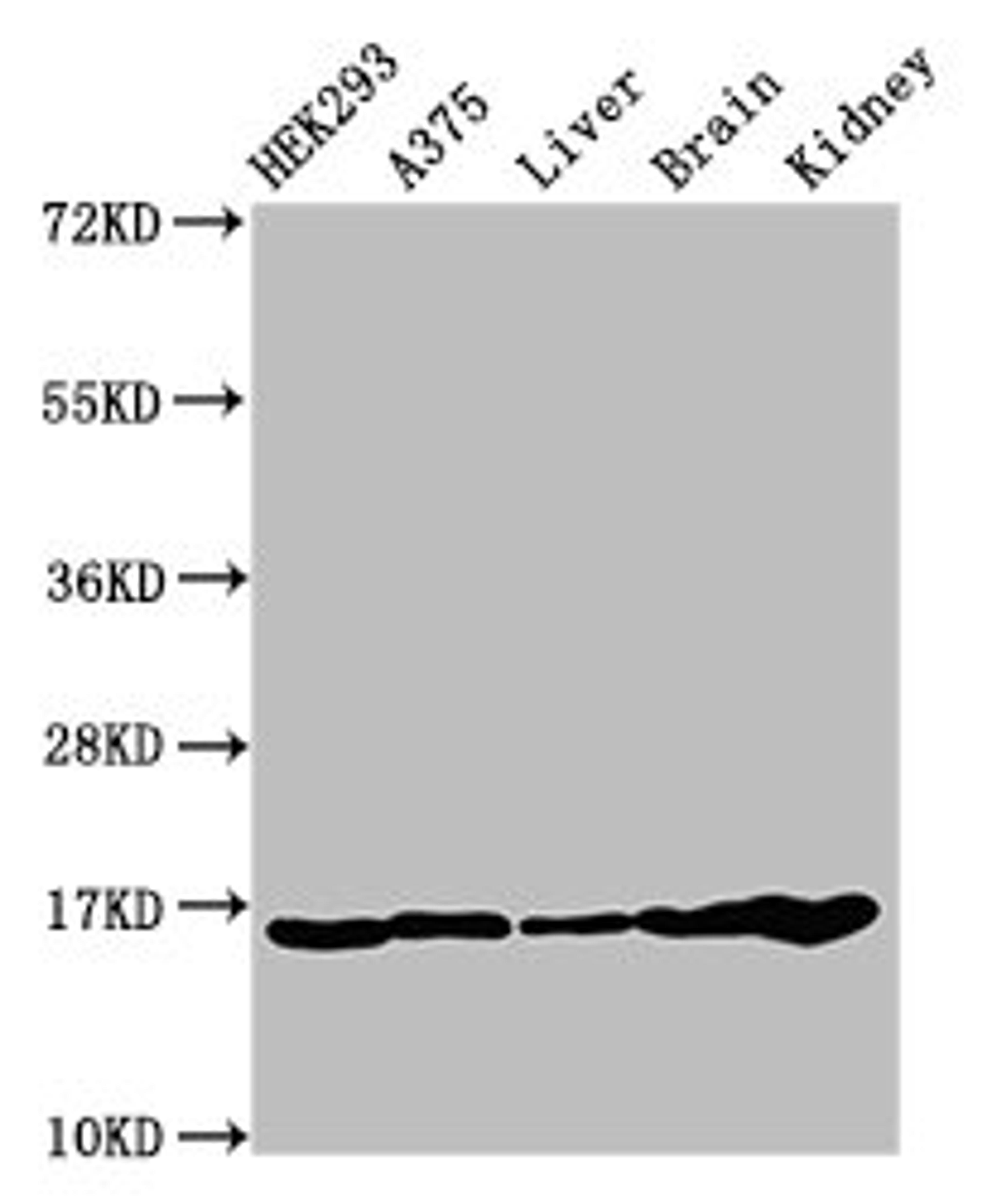 Western Blot. Positive WB detected in: HEK293 cell acid extracts, A375 cell acid extracts, Mouse liver tissue, Mouse brain tissue, Mouse kidney tissue. All lanes: HIST1H3A antibody at 1µg/ml. Secondary. Goat polyclonal to rabbit IgG at 1/50000 dilution. Predicted band size: 16 kDa. Observed band size: 16 kDa