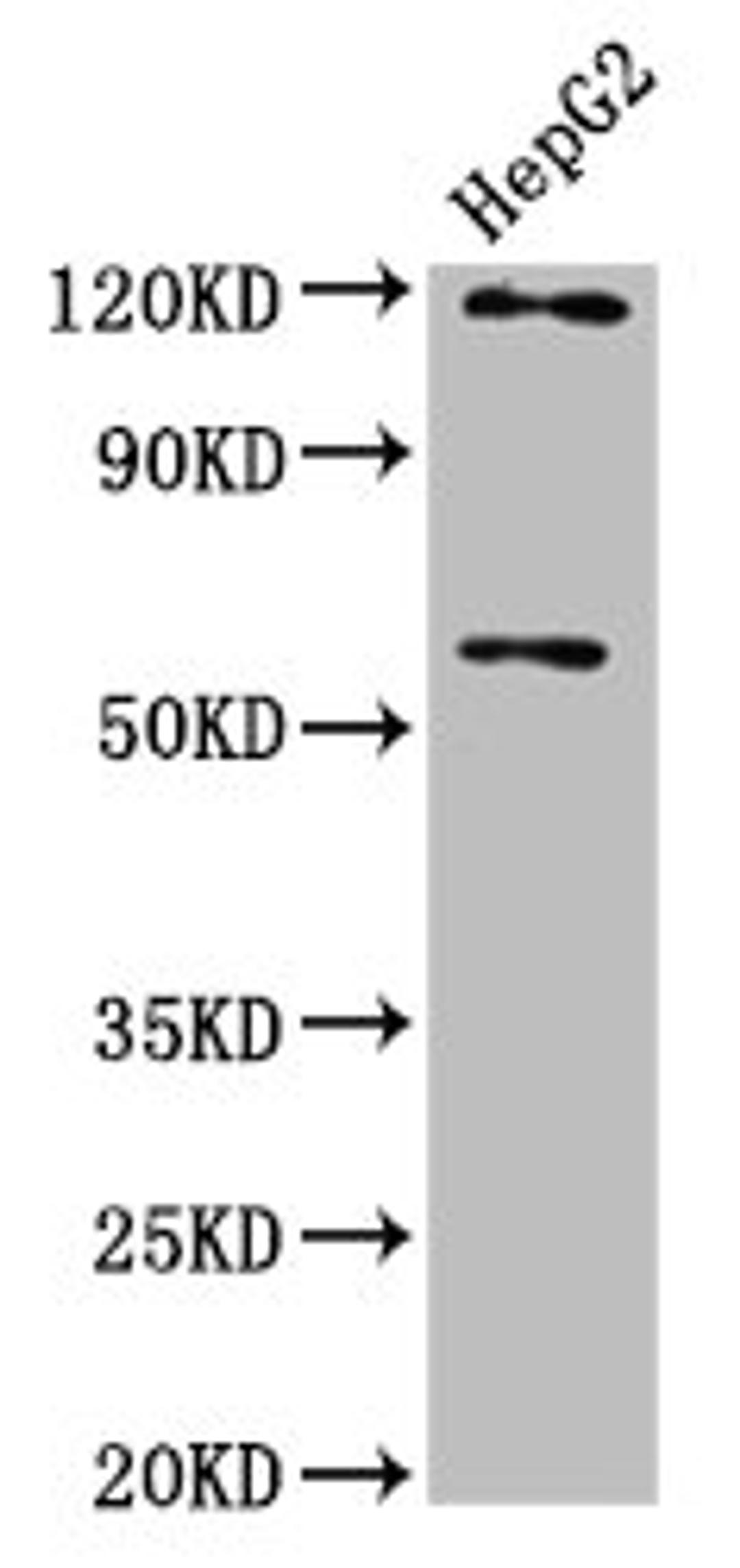 Western Blot. Positive WB detected in: HepG2 whole cell lysate. All lanes: FAM20C antibody at 4.1µg/ml. Secondary. Goat polyclonal to rabbit IgG at 1/50000 dilution. Predicted band size: 67, 30 kDa. Observed band size: 67 kDa