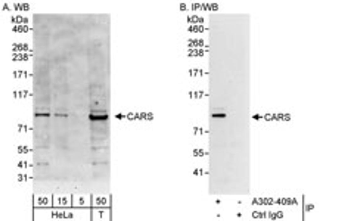 Detection of human CARS by western blot and immunoprecipitation.