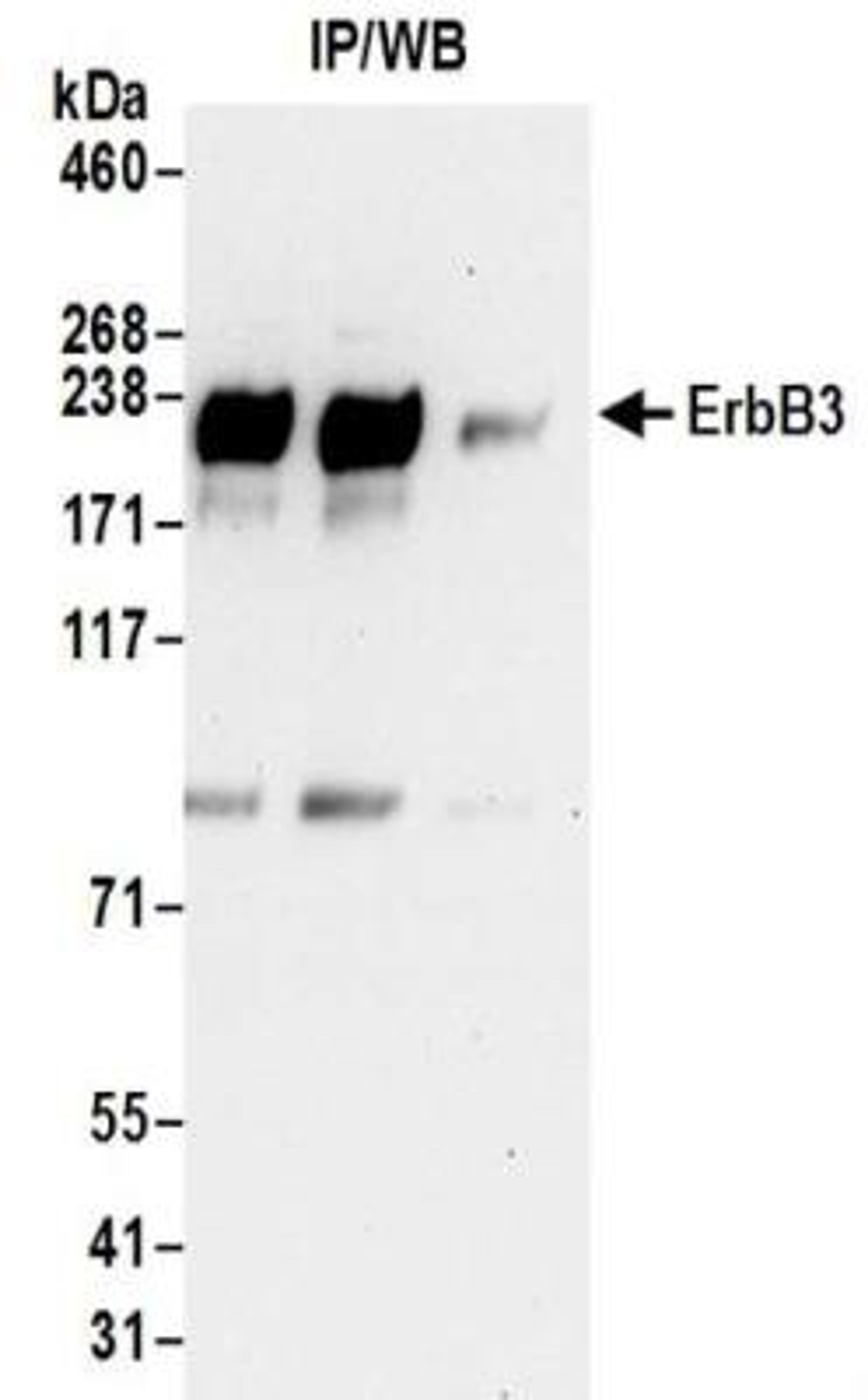 Immunoprecipitation: ErbB3 Antibody [NBP2-32253] - Samples:  Whole cell lysate (0.5 or 1.0 mg per IP reaction; 20% of IP loaded) prepared using RIPA buffer from MCF7 cells.  Antibodies:  Affinity purified rabbit anti-ErbB3 antibody NBP2-32253 used for IP at 6 ug per reaction. For blotting immunoprecipitated ErbB3, NBP2-32253 was used at 1 ug/ml. Detection: Chemiluminescence with an exposure time of 30 seconds.