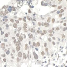 Detection of human Kap-1 by immunohistochemistry.