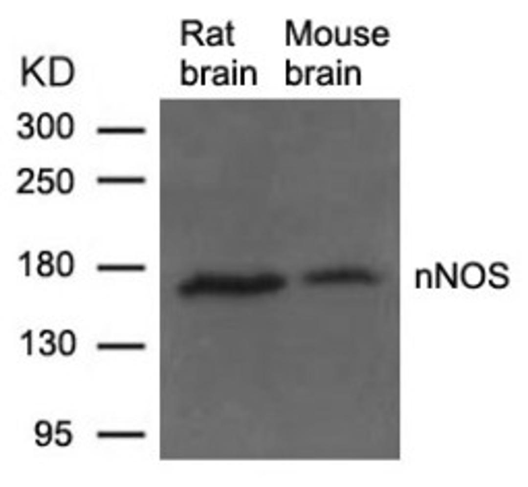 Western blot analysis of lysed extracts from Rat and Mouse brain tissue using nNOS (Ab-852).