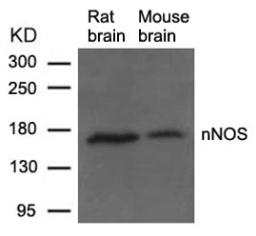 Western blot analysis of lysed extracts from Rat and Mouse brain tissue using nNOS (Ab-852).