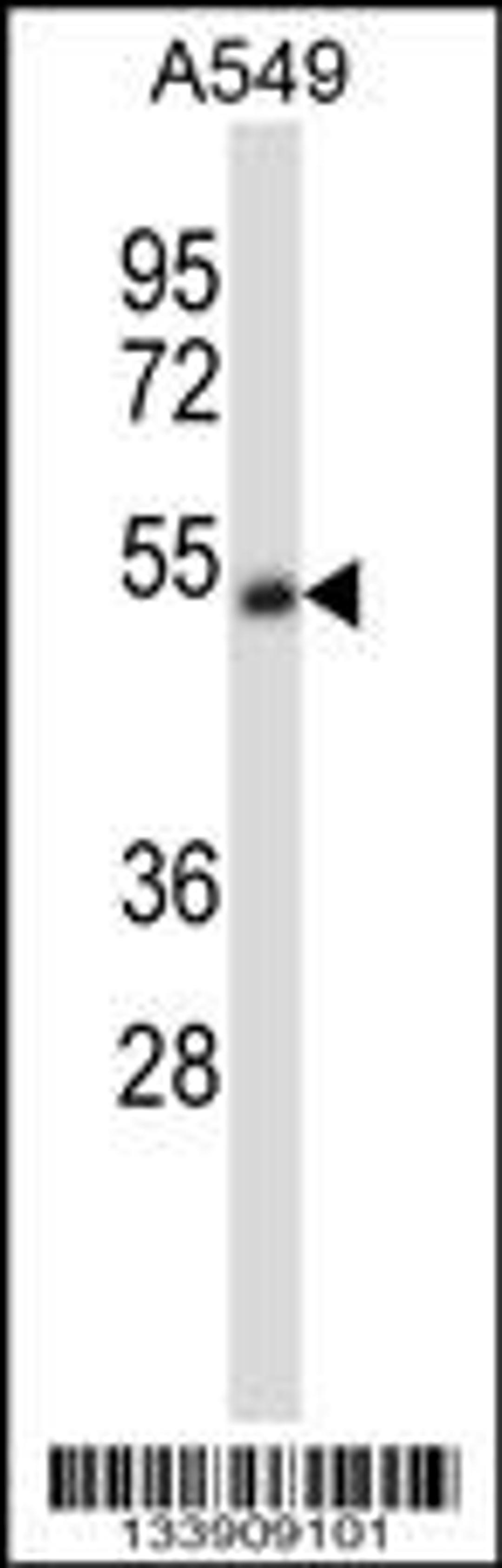 Western blot analysis in A549 cell line lysates (35ug/lane).