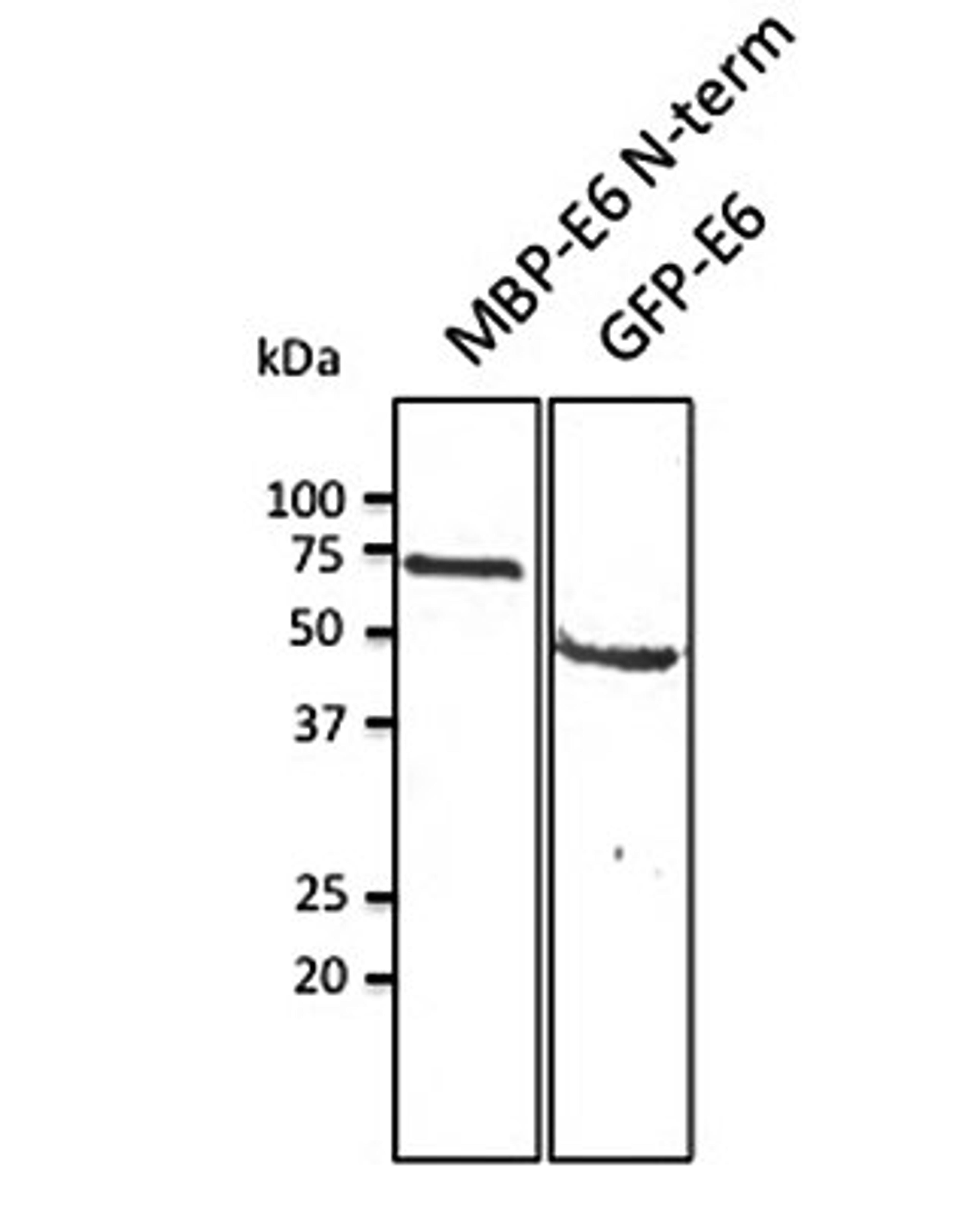 Western blot analysis of HEK293 cell line lysate and MBP-E6 (N-term) recombinant protein using HPV11 E6 antibody.