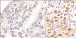 Detection of human and mouse CSN2 by immunohistochemistry.