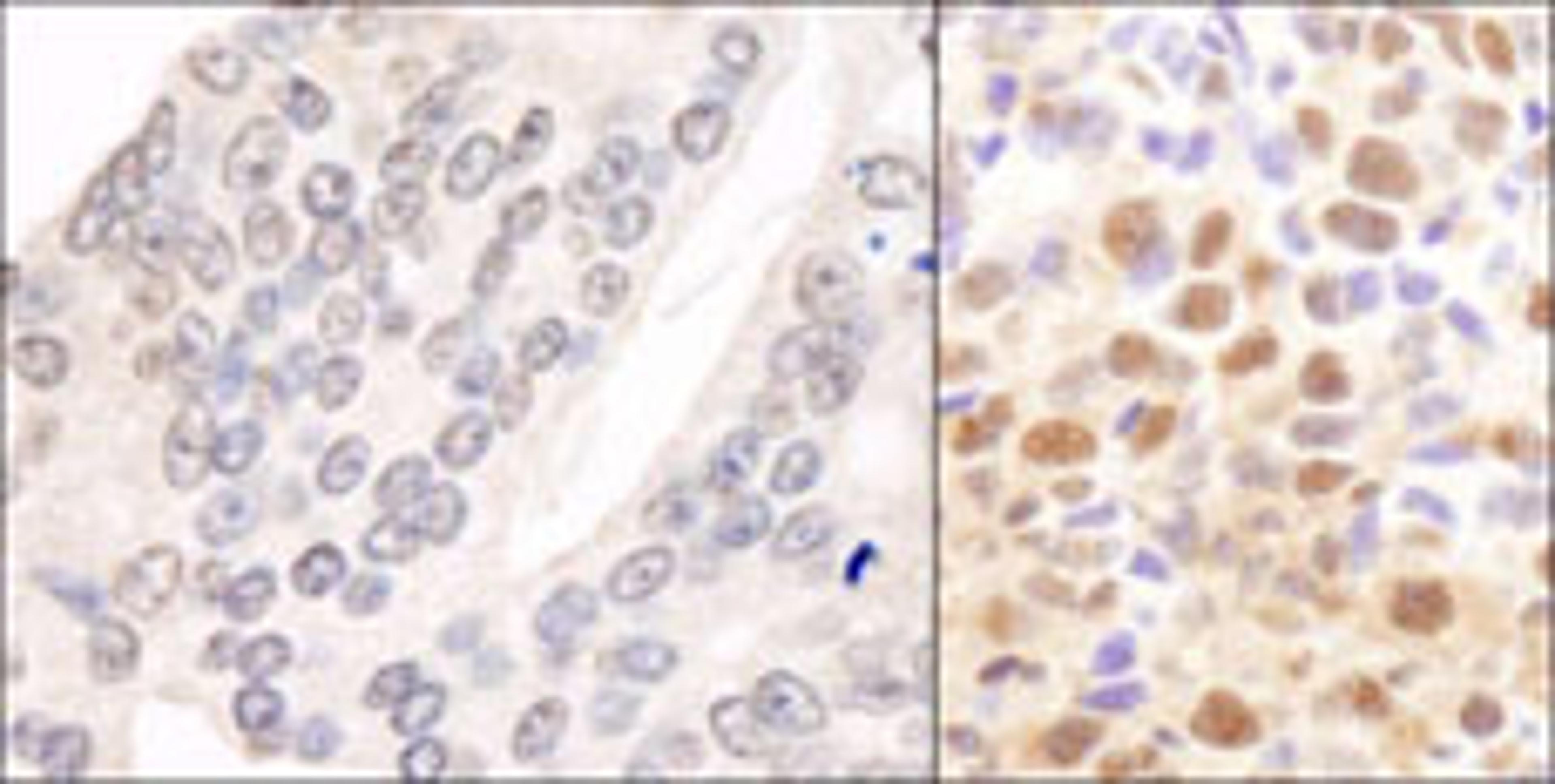 Detection of human and mouse CSN2 by immunohistochemistry.