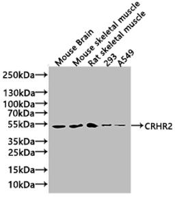 Western Blot. Positive WB detected in: Rat brain tissue, Mouse brain tissue. All lanes: CRHR2 antibody at 3ug/ml. Secondary. Goat polyclonal to rabbit IgG at 1/50000 dilution. Predicted band size: 48, 51, 47, 45, 43 kDa. Observed band size: 34 kDa. 