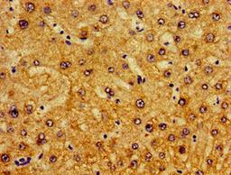 Immunohistochemistry of paraffin-embedded human liver tissue using CSB-PA018032LA01HU at dilution of 1:100