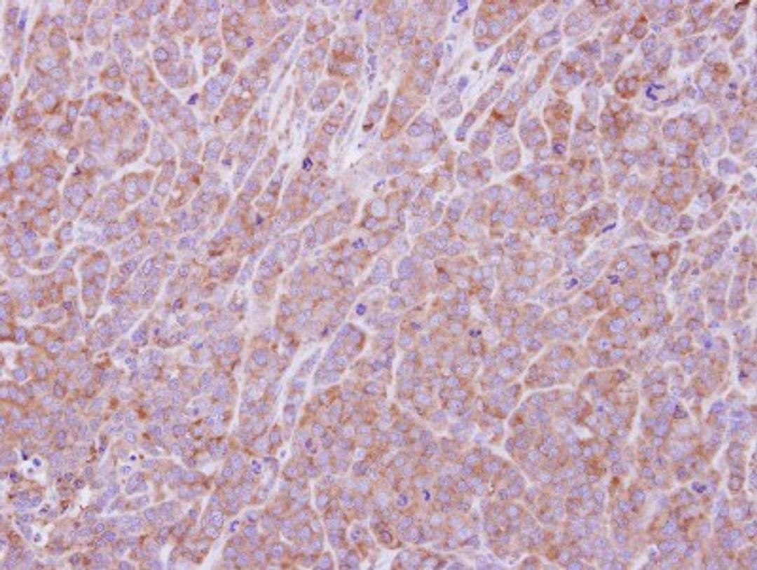 Immunohistochemistry-Paraffin: eIF2B1 Antibody [NBP2-16292] - Immunohistochemical analysis of paraffin-embedded BT483 xenograft, using antibody at 1:500 dilution.