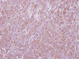 Immunohistochemistry-Paraffin: eIF2B1 Antibody [NBP2-16292] - Immunohistochemical analysis of paraffin-embedded BT483 xenograft, using antibody at 1:500 dilution.