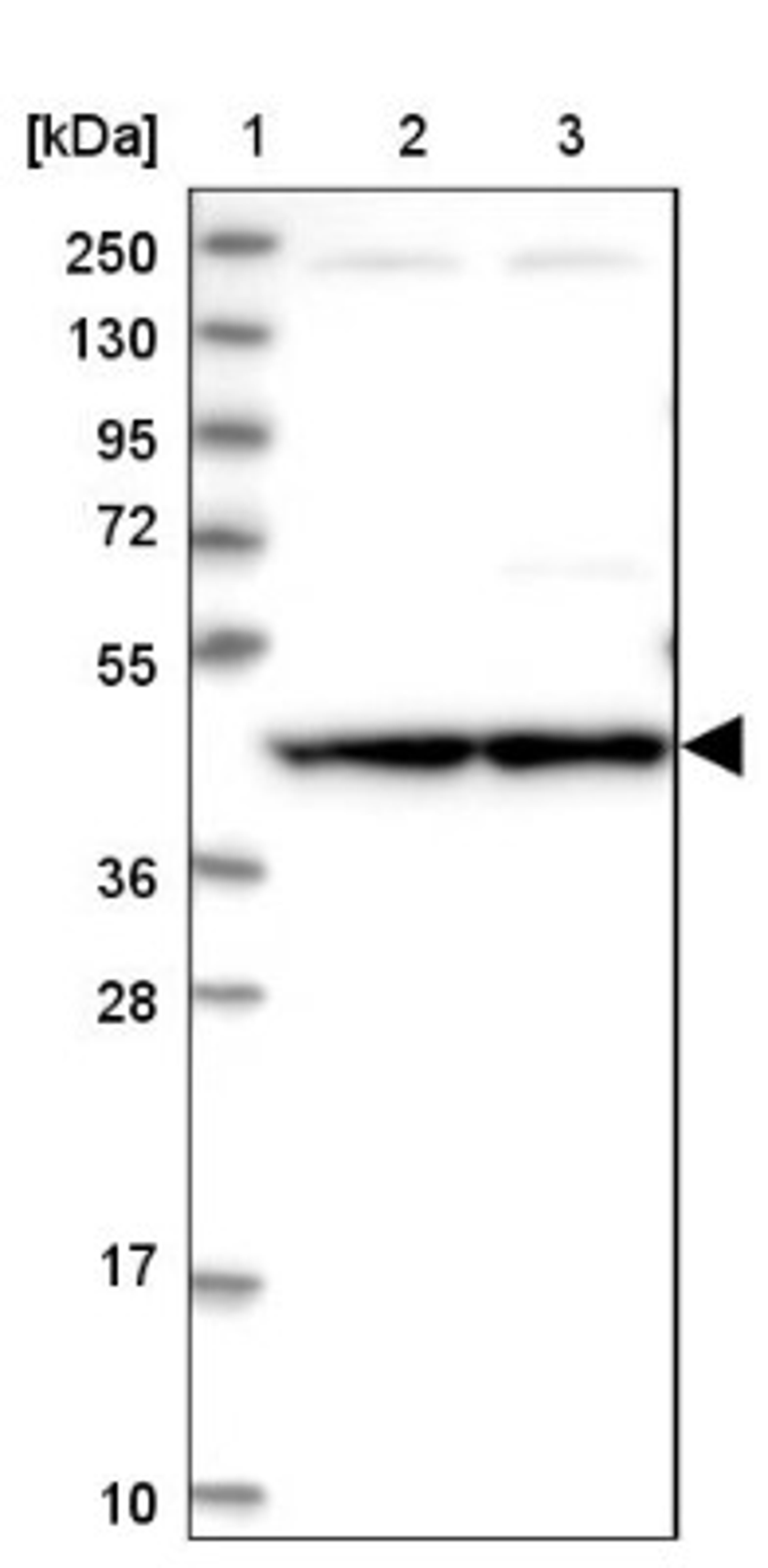 Western Blot: CCBE1 Antibody [NBP1-83544] - Lane 1: Marker [kDa] 250, 130, 95, 72, 55, 36, 28, 17, 10<br/>Lane 2: Human cell line RT-4<br/>Lane 3: Human cell line U-251MG sp