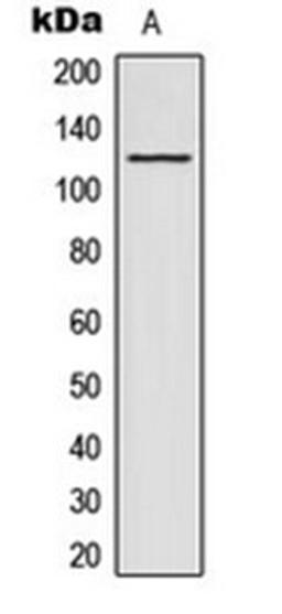 Western blot analysis of HeLa (Lane 1) whole cell lysates using ACAD10 antibody