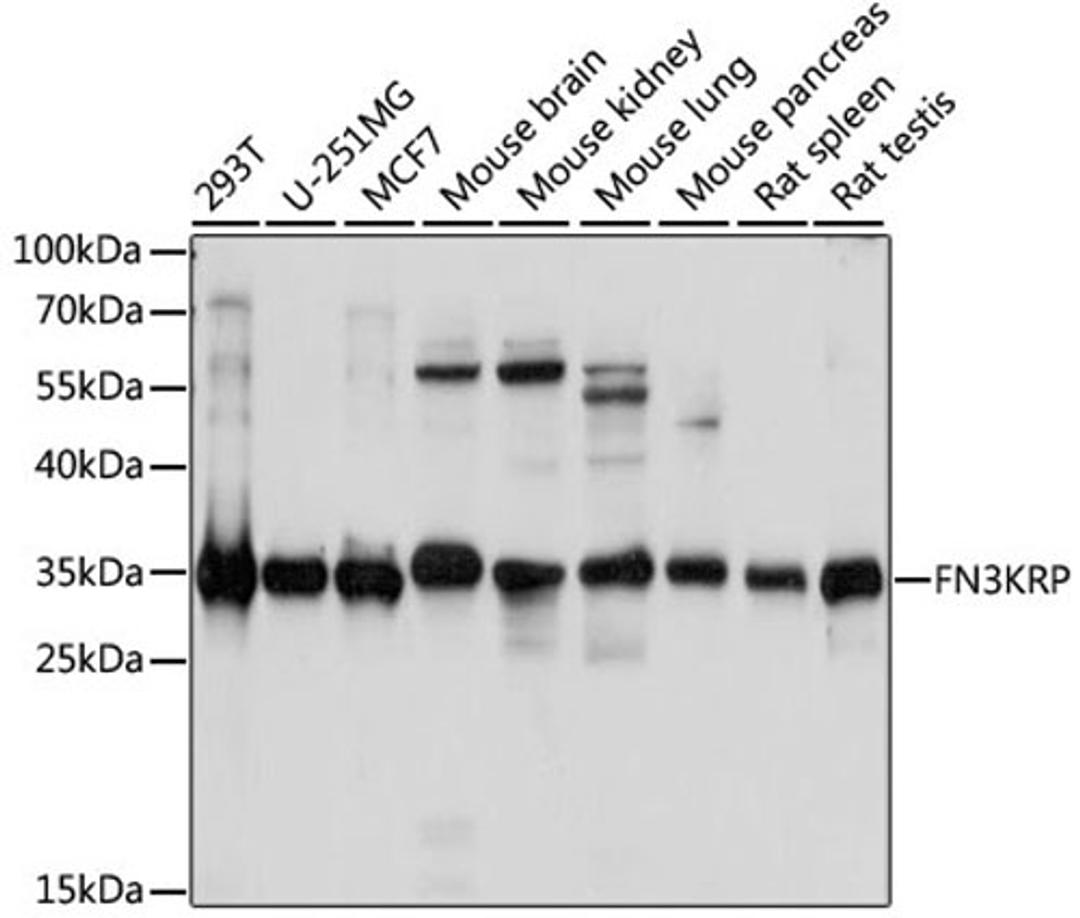 Western blot - FN3KRP antibody (A15512)