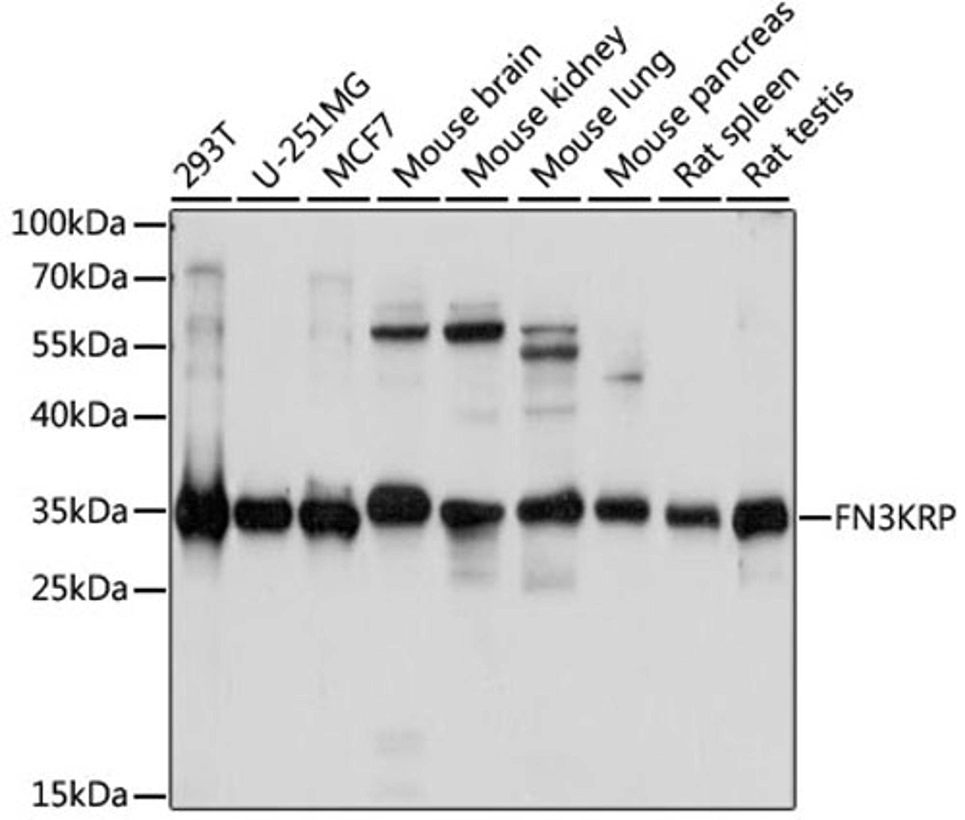 Western blot - FN3KRP antibody (A15512)