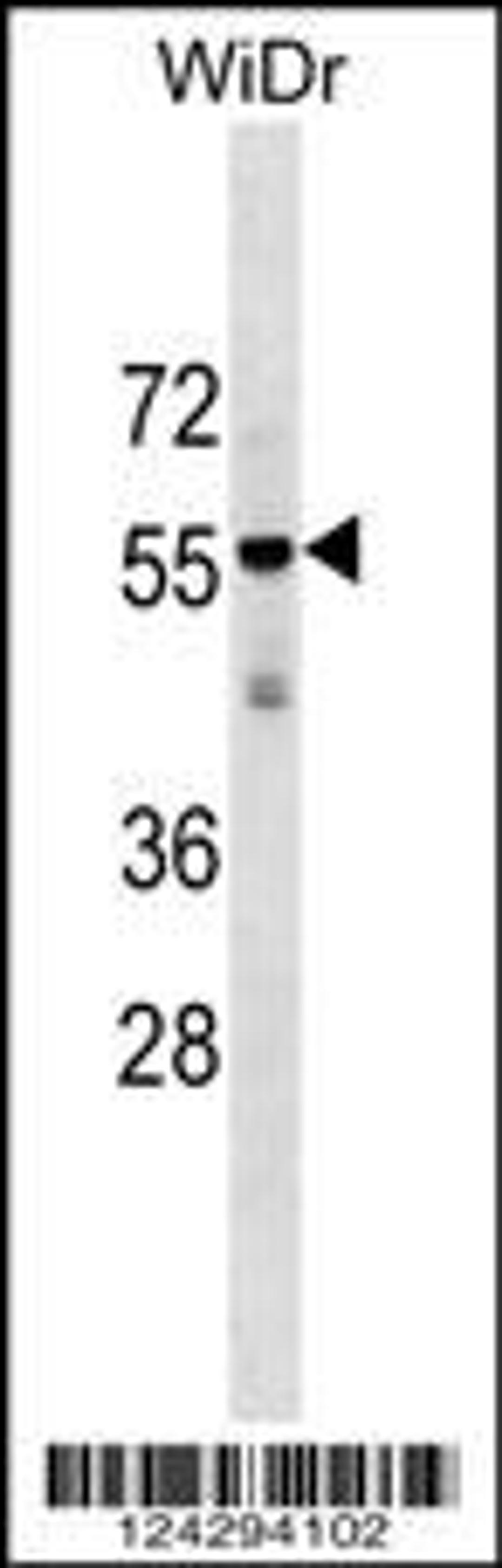 Western blot analysis in WiDr cell line lysates (35ug/lane).