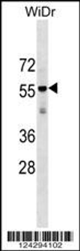 Western blot analysis in WiDr cell line lysates (35ug/lane).