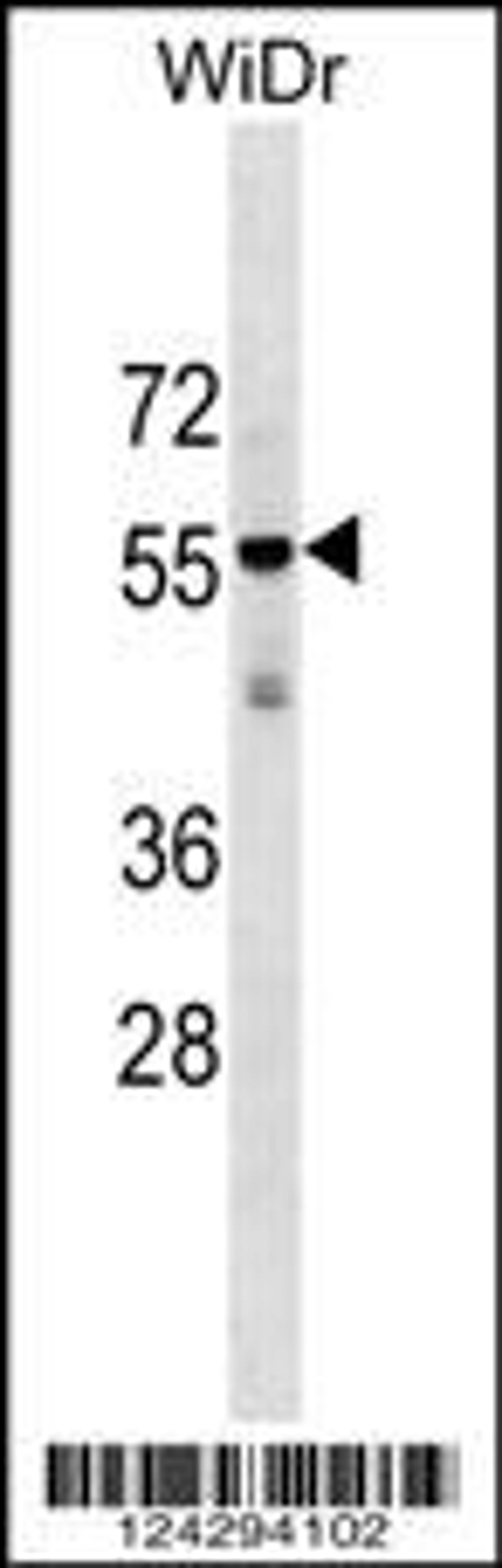 Western blot analysis in WiDr cell line lysates (35ug/lane).