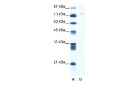 Antibody used in WB on Human Jurkat 5.0 ug/ml.