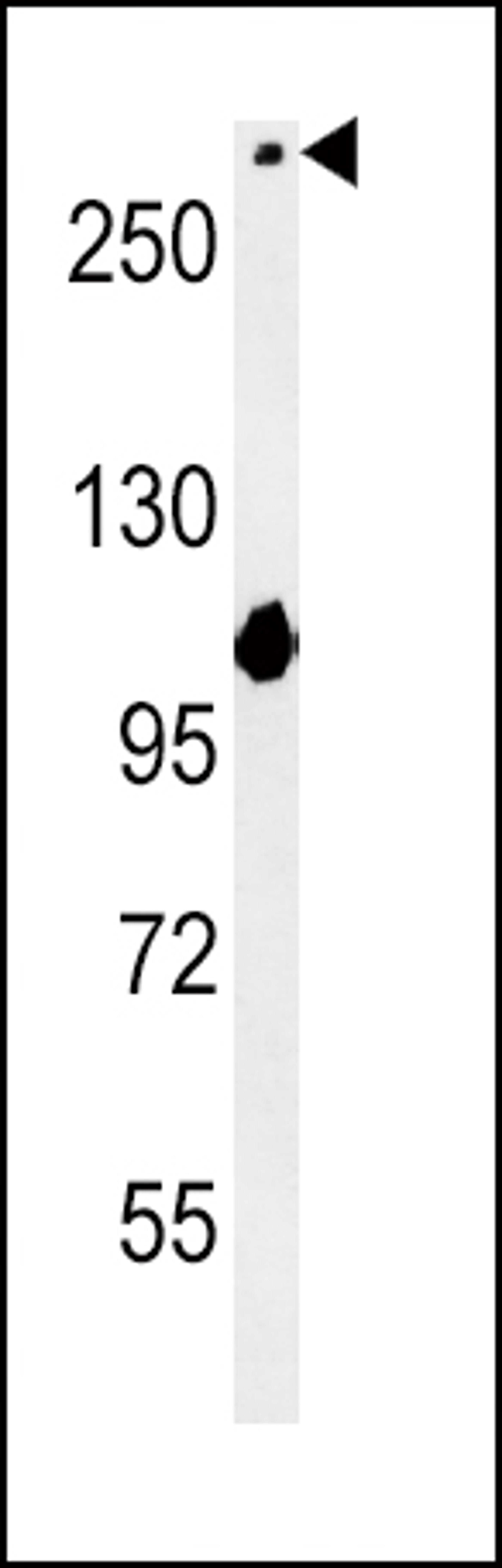 Western blot analysis in mouse NIH-3T3 cell line lysates (15ug/lane).This demonstrates the NOTdetected the NOTCH3 protein (arrow).