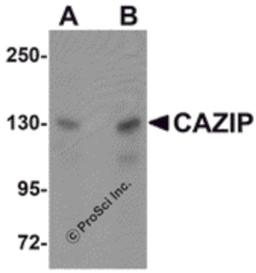 Western blot analysis of CAZIP in A20 cell lysate with CAZIP antibody at (A) 0.5 and (B) 1 μg/mL.