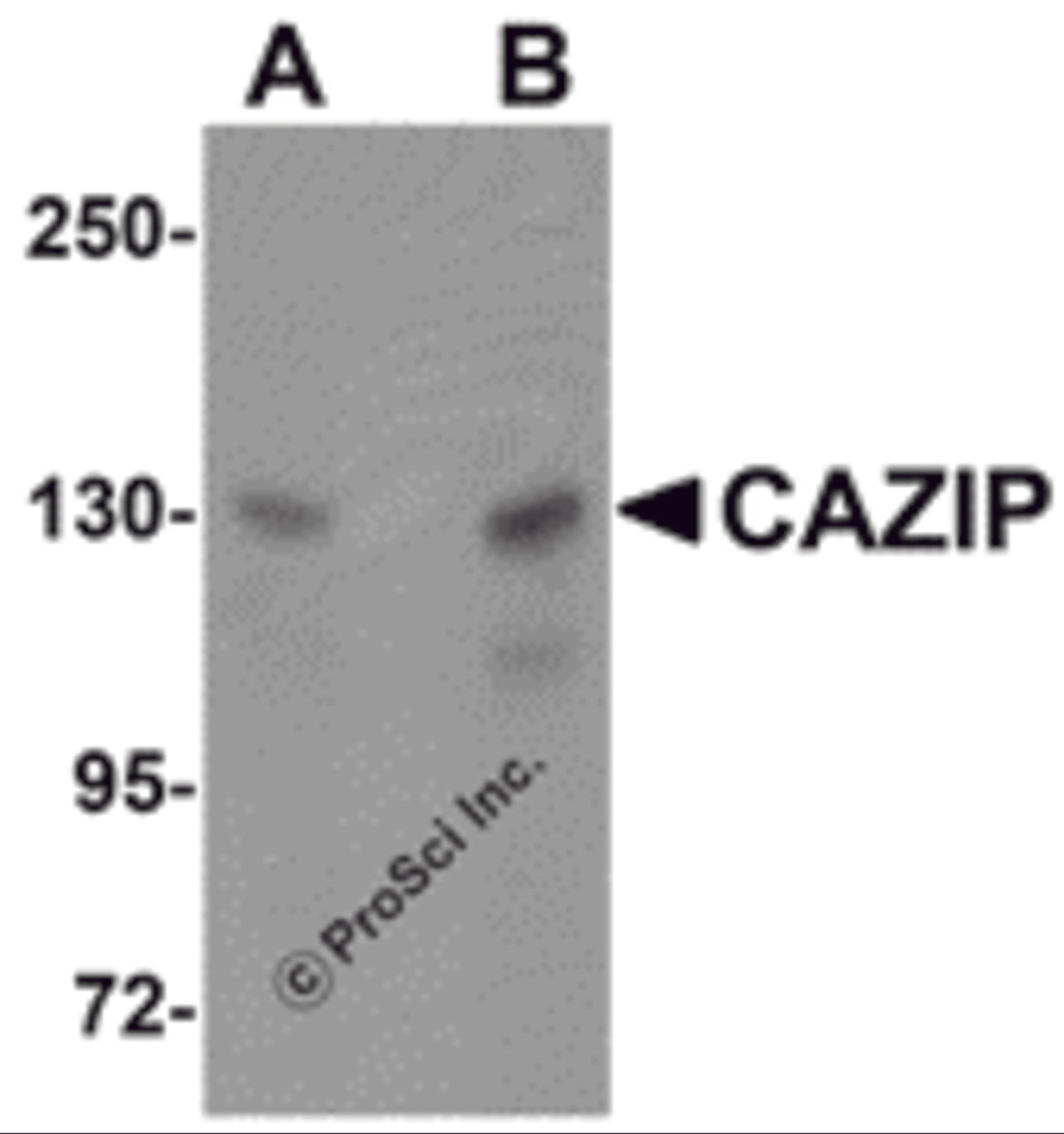 Western blot analysis of CAZIP in A20 cell lysate with CAZIP antibody at (A) 0.5 and (B) 1 μg/mL.