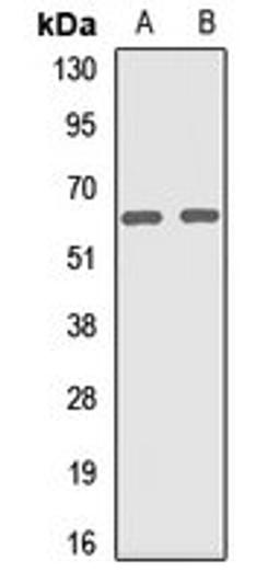 Western blot analysis of A549 (Lane1), MCF7 (Lane2) whole cell lysates using VPS33B antibody