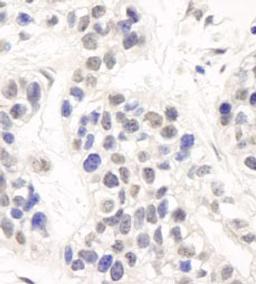 Detection of human Artemis by immunohistochemistry.