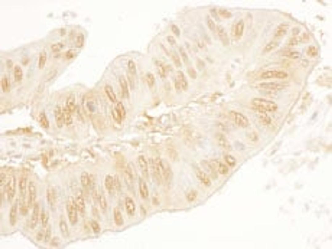 Detection of human SA2 by immunohistochemistry.