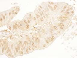 Detection of human SA2 by immunohistochemistry.