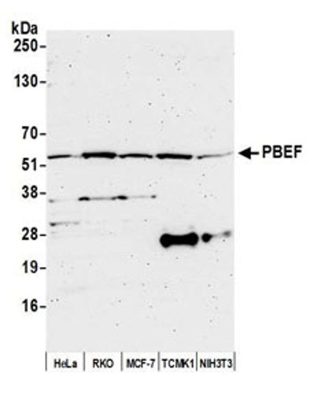 Detection of human and mouse PBEF by western blot.