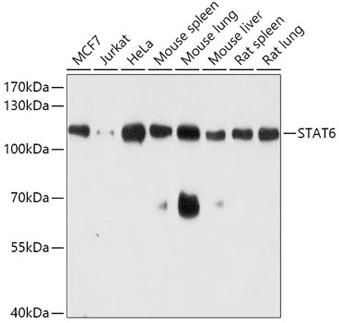 Western blot - STAT6 antibody (A0755)