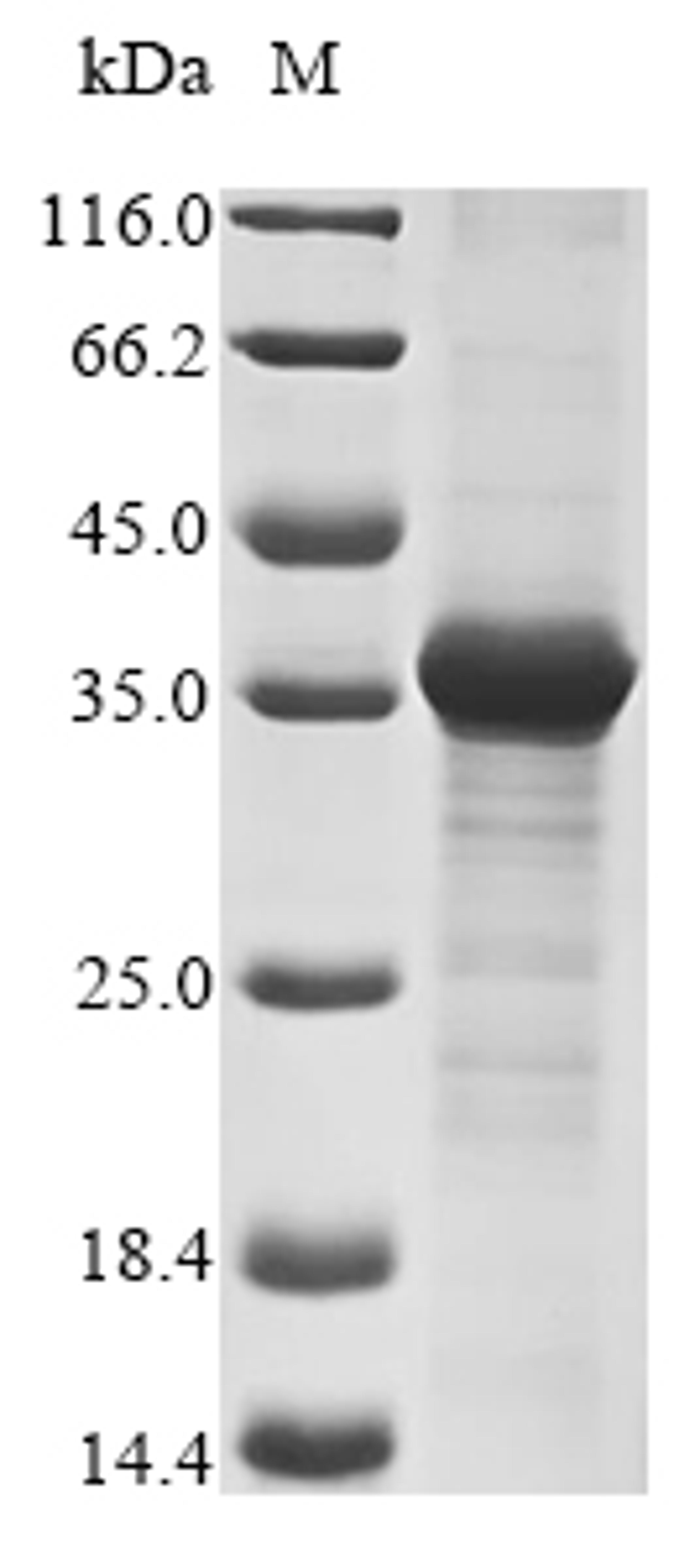 (Tris-Glycine gel) Discontinuous SDS-PAGE (reduced) with 5% enrichment gel and 15% separation gel.