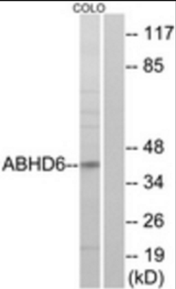 Western blot analysis of COLO cells using ABHD6 antibody