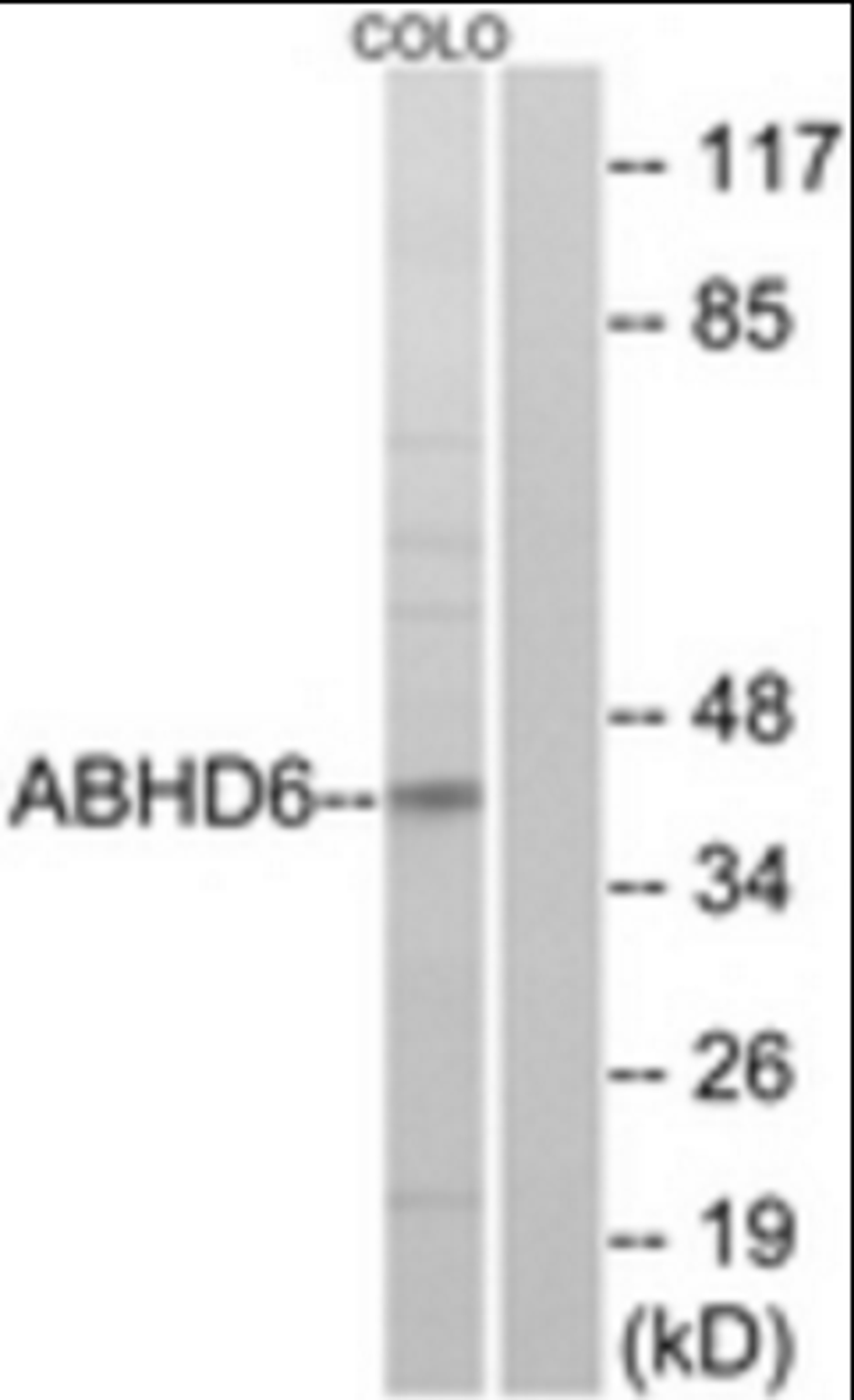 Western blot analysis of COLO cells using ABHD6 antibody