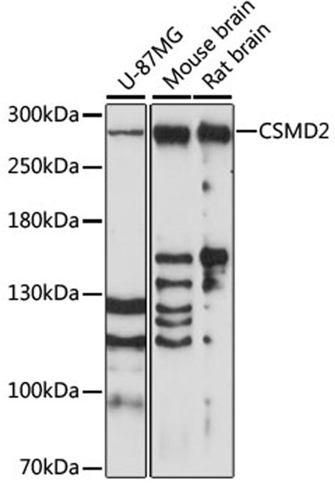 Western blot - CSMD2 antibody (A14229)