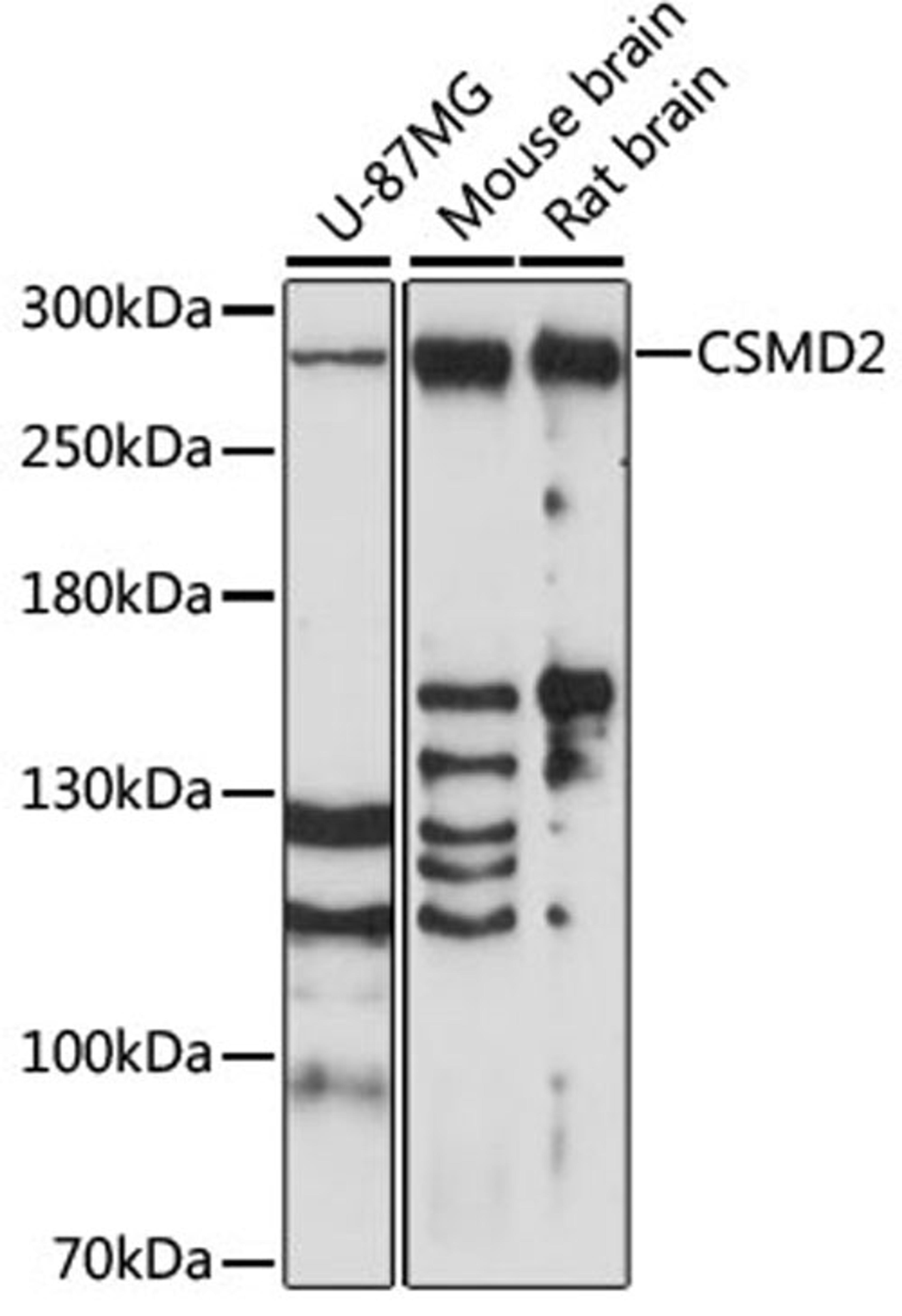 Western blot - CSMD2 antibody (A14229)