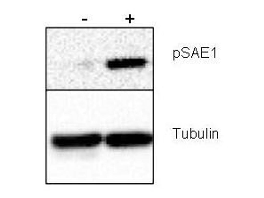 Western blot analysis of human HeLa whole cell protein using SAE1 (phospho-S185) antibody