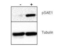 Western blot analysis of human HeLa whole cell protein using SAE1 (phospho-S185) antibody