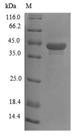 (Tris-Glycine gel) Discontinuous SDS-PAGE (reduced) with 5% enrichment gel and 15% separation gel.